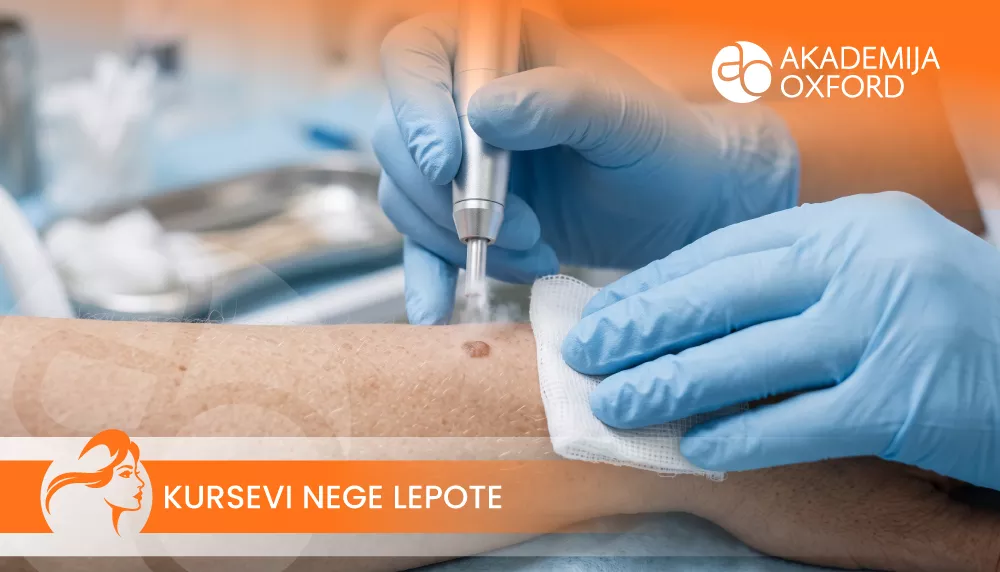 Kurs i obuka — naučite da uklonite virusne bradavice uz pomoć radiotalasa