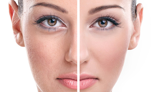 Kursevi nege lepote: Upoznajte kozmetičke tretmane za podmlađivanje kože