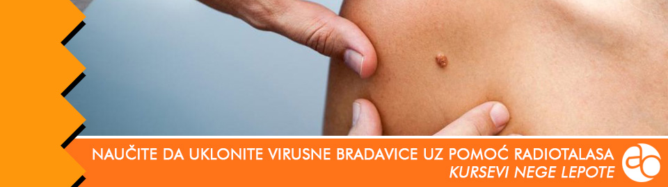 Kurs i obuka - naučite da uklonite virusne bradavice uz pomoć radiotalasa