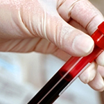 Medicinska sestra za rad u transfuziji krvi - Peti stepen smer