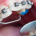 Zubni tehničar za ortodonciju - peti stepen smer
